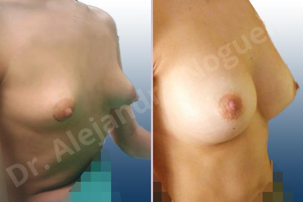 Before & After Case EXNFEMB7
