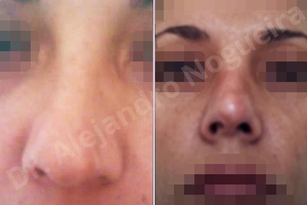 Before & After Case VAUA36KY
