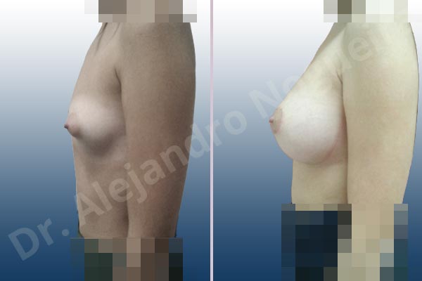 Before & After Case ZCG9TLH8