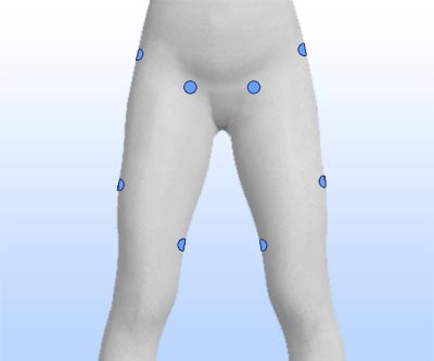 scars thigh liposuction